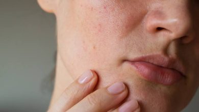Photo of Médicament contre l’acné sévère : Quels sont les risques pour les patients ?